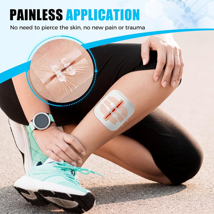 Senvok Wound Closure Device(Mix 4 PCS)