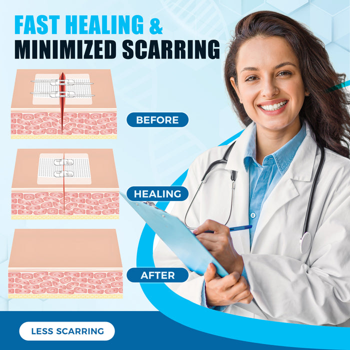 Senvok Wound Closure Device(Upgraded 2-Straps 4 PCS)