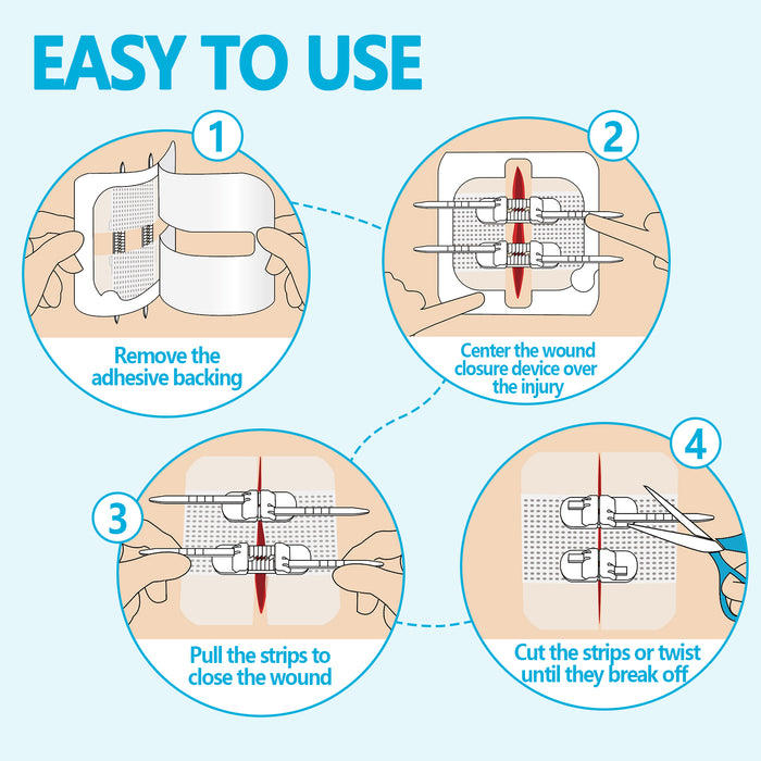 Senvok Wound Closure Device(Upgraded 2-Straps 4 PCS)