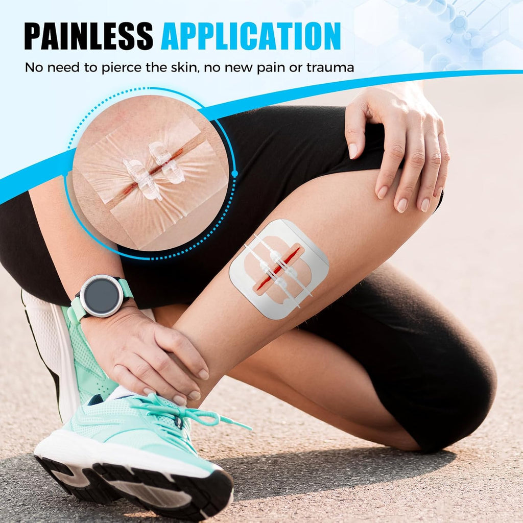 Senvok Wound Closure Device(Mix 4 PCS)