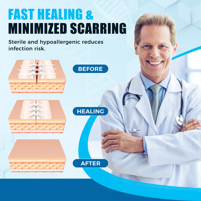 Senvok Wound Closure Device(PU 3 Straps)