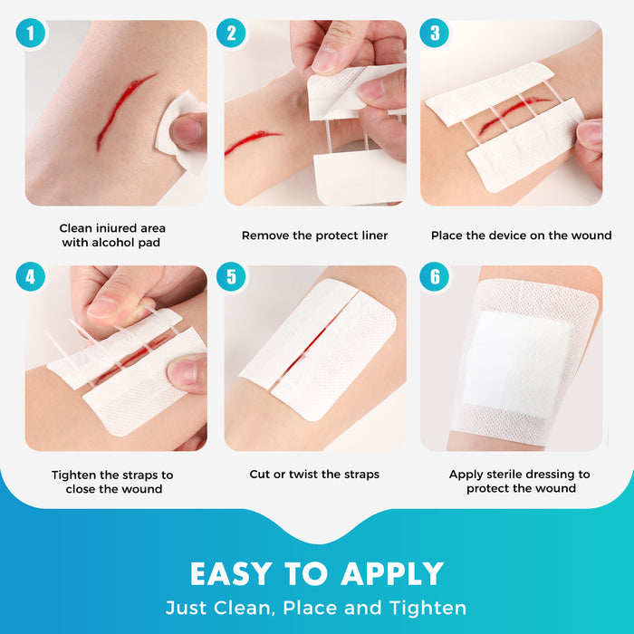 Senvok Wound Closure Device(Cotton 4 Straps)