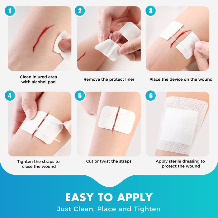 Senvok Wound Closure Device(Cotton 2 Straps)