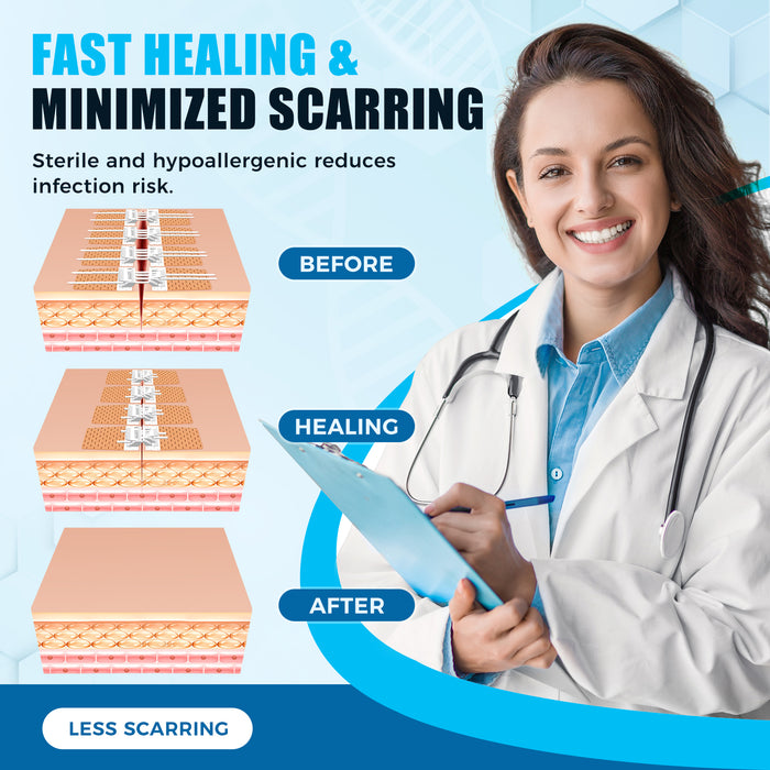 Senvok Wound Closure Device(Non-woven)