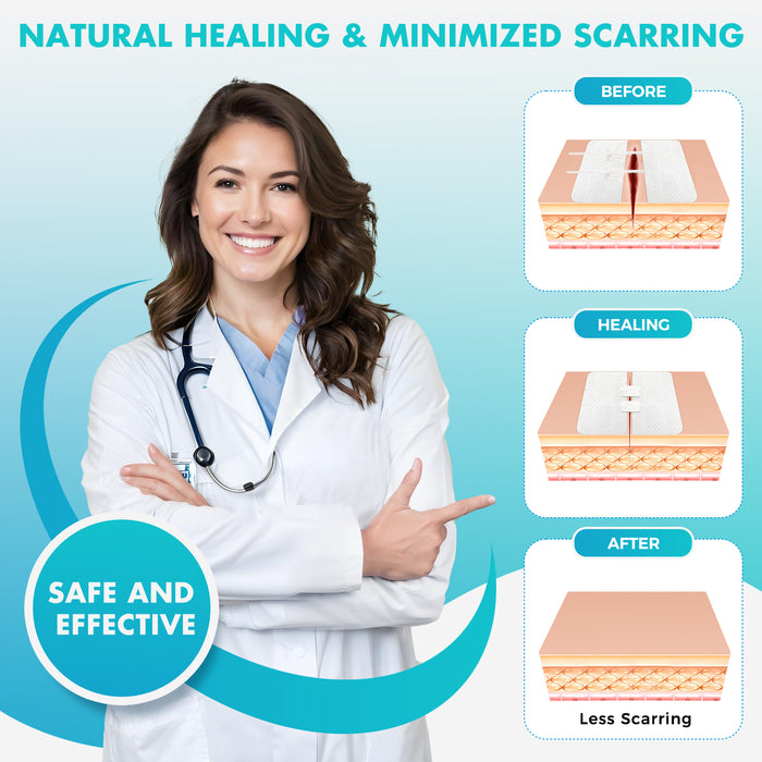 Senvok Wound Closure Device(Cotton 2 Straps)