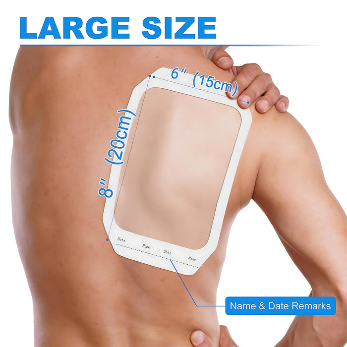 Senvok Transparent Film Dressing(15cm x 20cm,10 Pack)