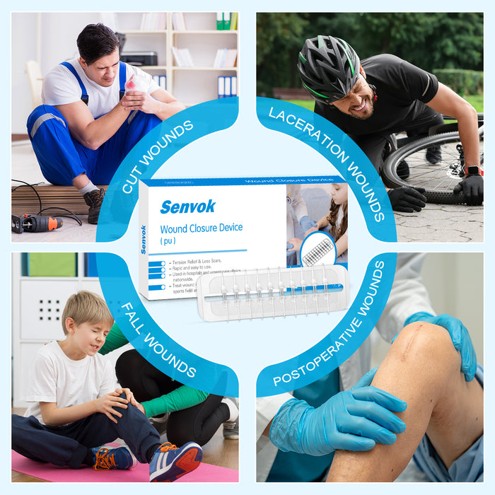 Wound closure device for cuts, lacerations, falls, and post-surgery incisions—zip stitch alternative to sutures and staples.