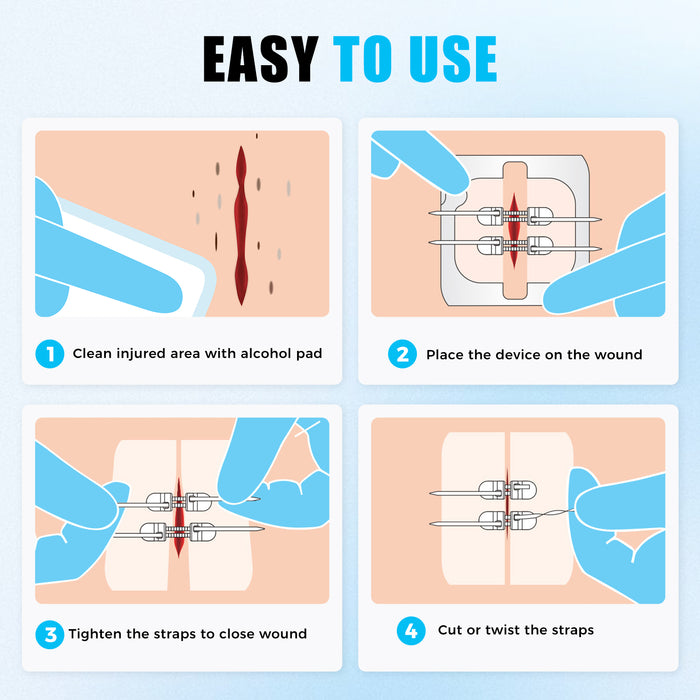 How to use a wound closure device: clean the cut, place skin closure strips, tighten to pull wound edges together, then trim the straps.