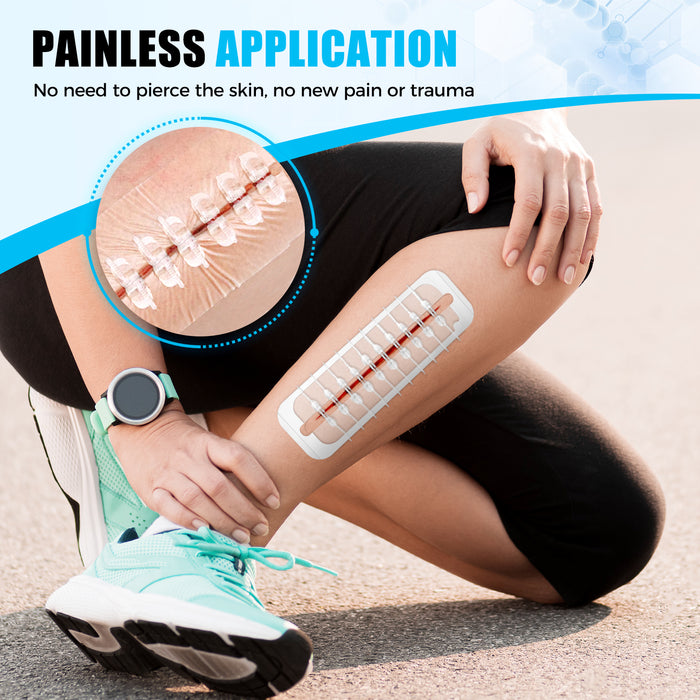 Painless skin closure device on lower leg, zipper bandage style wound closure strips that close cuts without needles or sutures.
