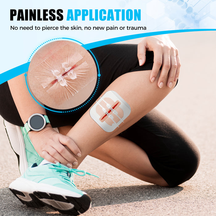 Painless wound closure strips on the lower leg, a zip stitch–style skin closure device that closes cuts without needles or sutures.