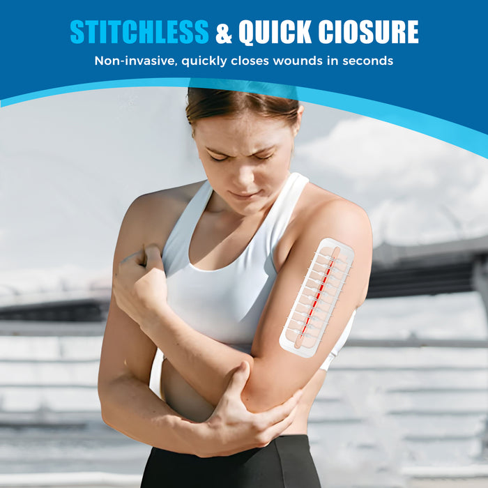 Stitchless wound closure strips on upper arm, non-invasive zip stitch alternative to sutures for fast cut and laceration closure.