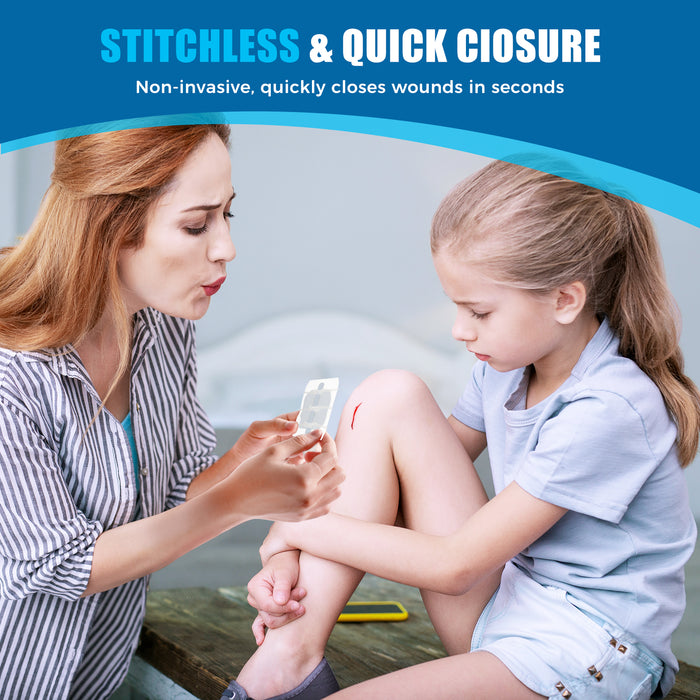 Caregiver applying a Senvok wound closure device to a child’s knee cut for fast, stitch-free closure.