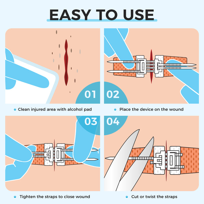 Step Closure Senvok Adjustable Zip Wound Closure Strips | Stitchless Kit